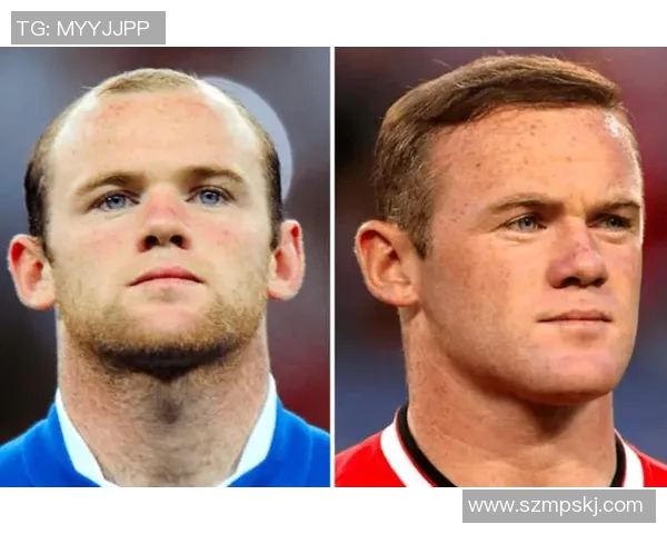 荷兰足球明星中有哪些以秃顶形象著称的球员和他们的成就